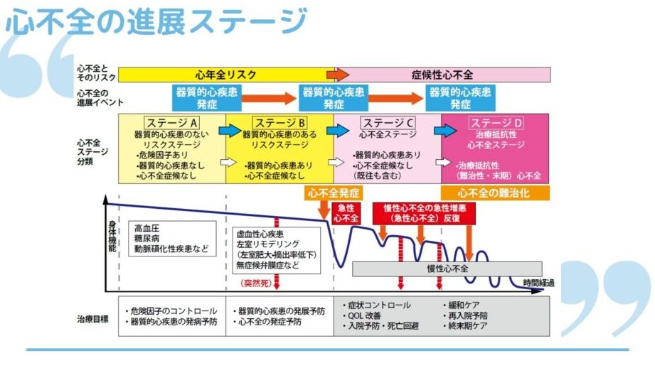 慢性心不全のステージはいくつですか？詳細解説